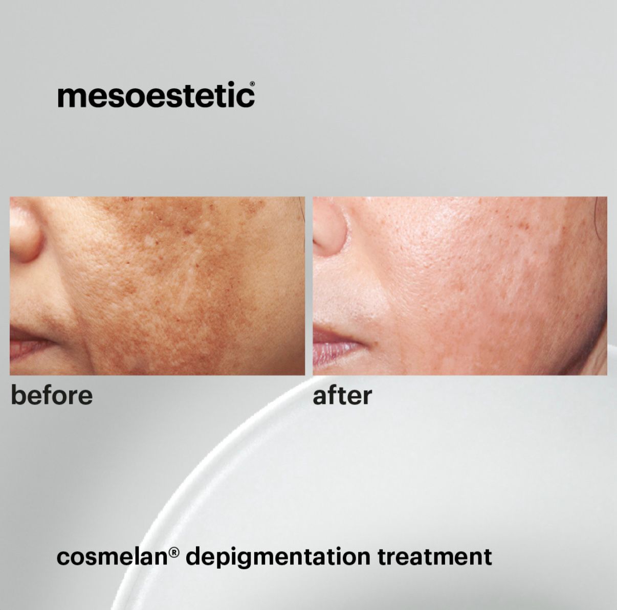 Cosmelan (3)